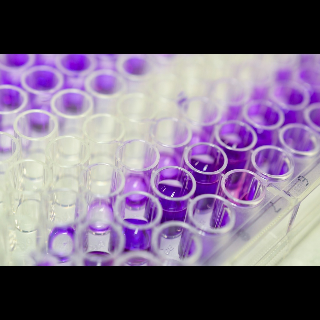 ELISA Kit for 2',5'size:Oligoadenylate Synthetase 1  OAS1 